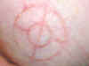 2-ring Cross-hair